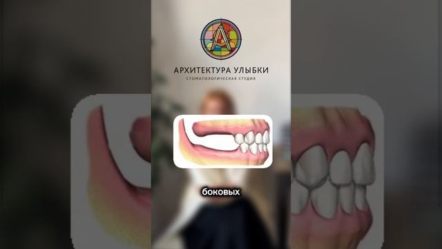 Как выбрать цвет виниров?