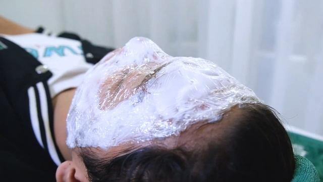 Извлечение угрей и камедонов - очень залипательно и раслабляет