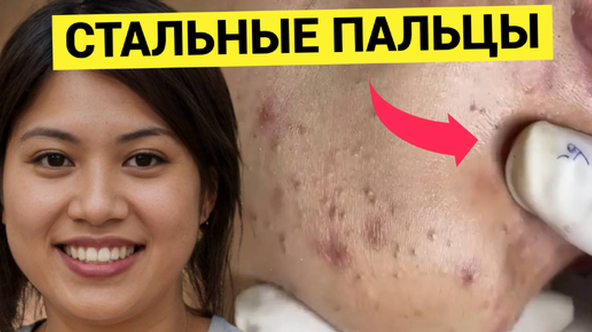 СТАЛЬНЫЕ Пальцы Чистят Кожу без Жалости и Упрёка. А глаза Добрые Такие