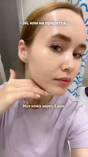 Что я делаю с прыщами