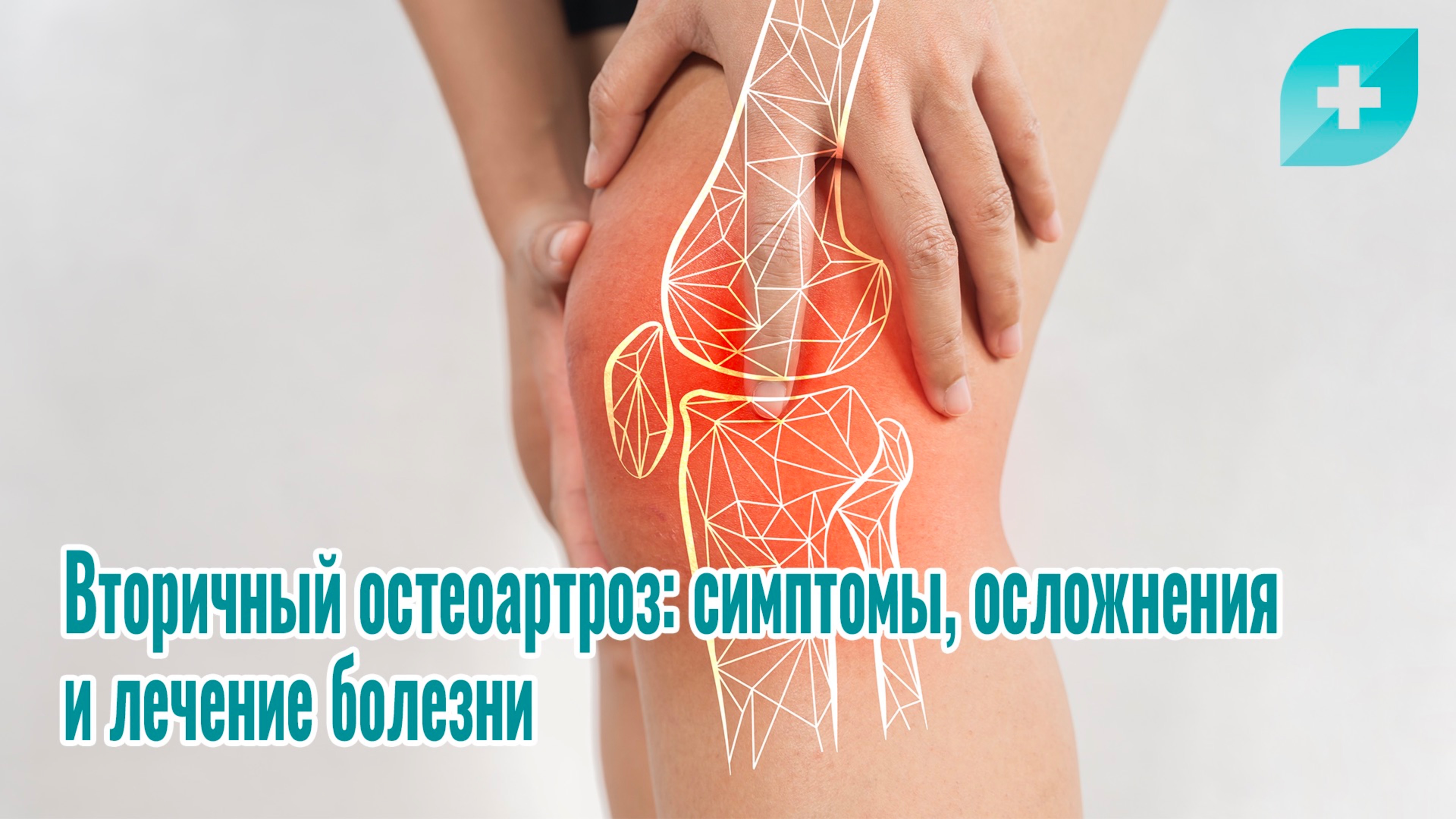 Вторичный остеоартроз: симптомы, осложнения и лечение болезни