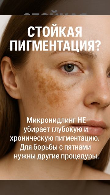 Развенчиваем мифы о микронидлинге.