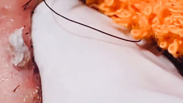Механическая чистка лица