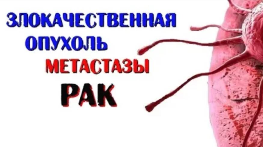 Что такое злокачественная опухоль, рак, метастазы?