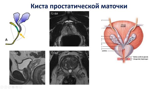 ЛД в онкологии. Часть 1 9. Лекция «Рак предстательной железы