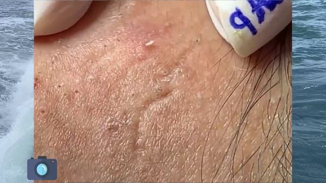 Щекастый БАТЫР на Чистке Лица Отдыхает и Мы Отдохнём
