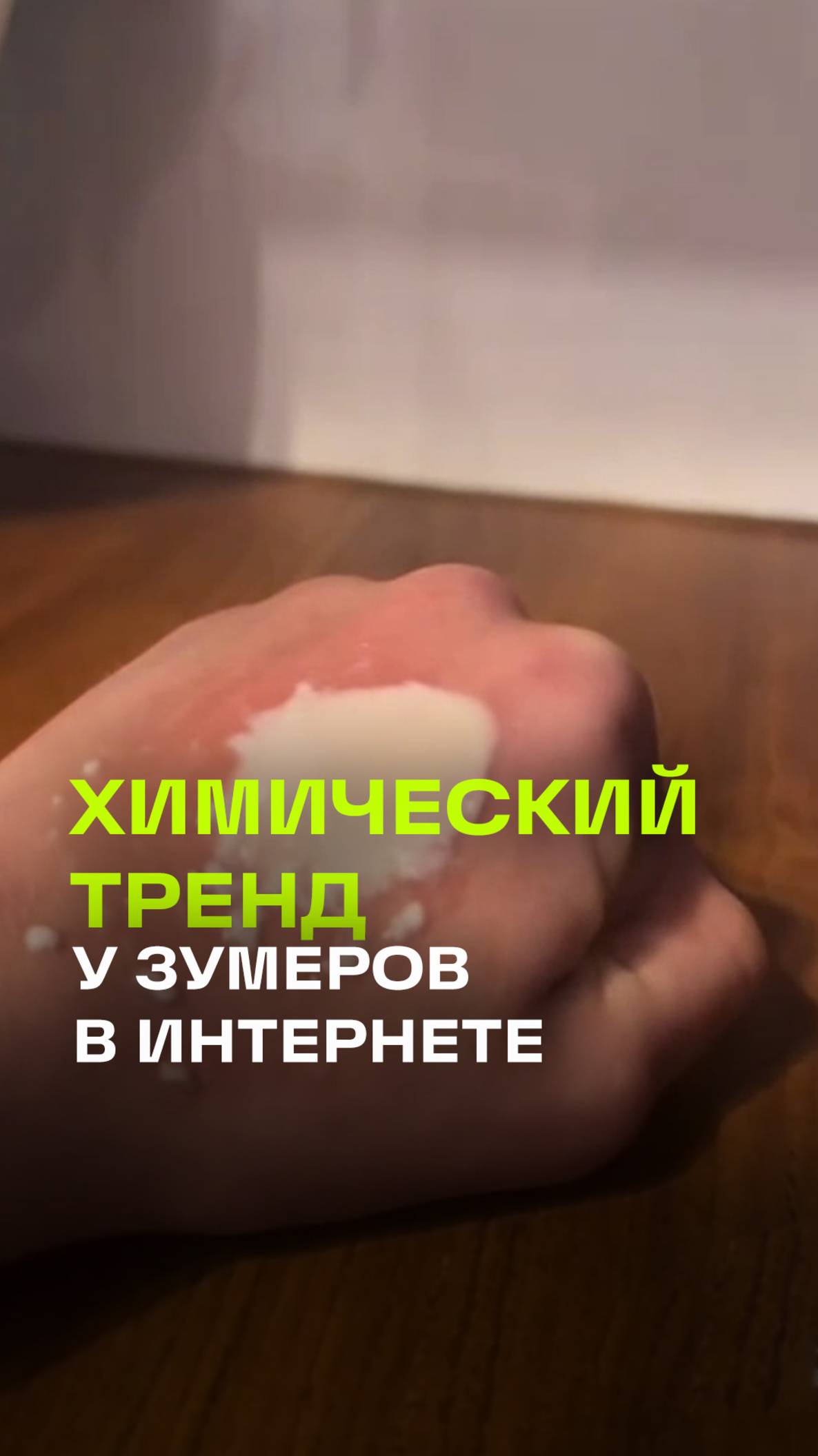 Ожоги на руке стали модными? Новый тренд зумеров в нынешних реалиях интернета