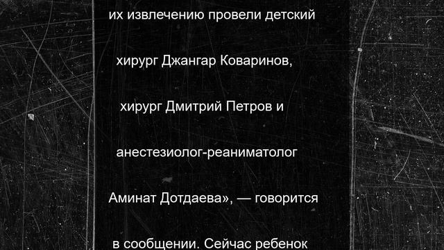 Врачи больницы в Тазовском достали из кишечника ребенка 11 магнитов