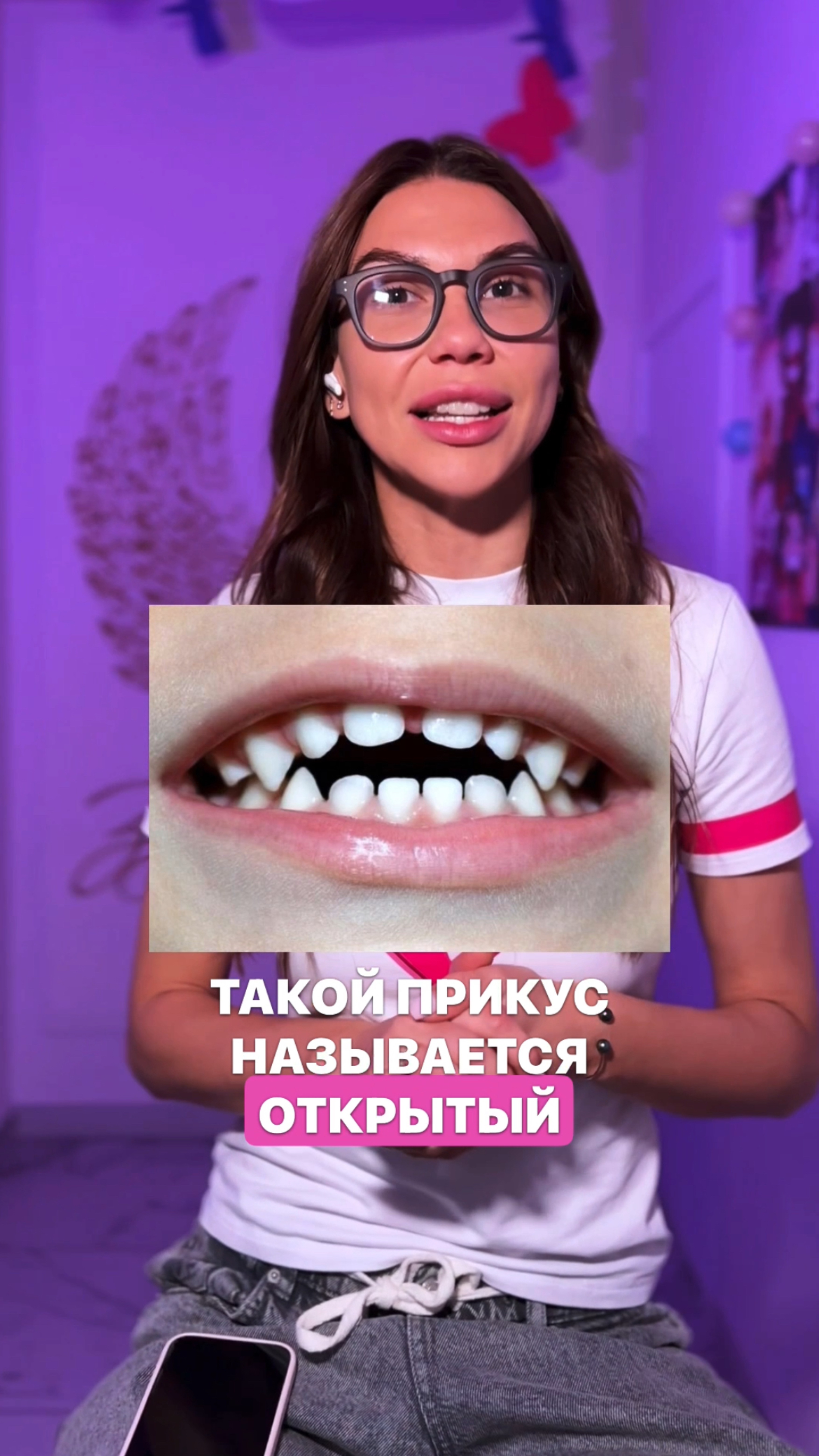 Что такое открытый прикус и как его исправить?