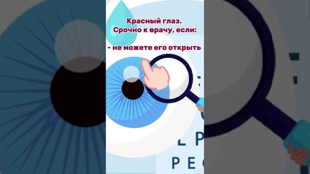 «Красный глаз»: когда. срочно к врачу?