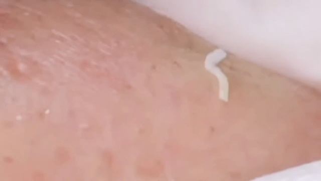 Механическая чистка лица