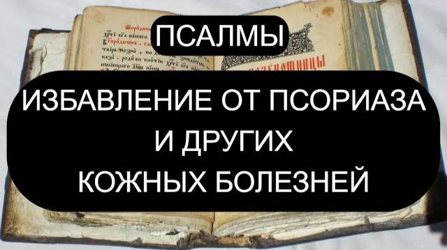 ЛЕЧИМ ПСОРИАЗ И КОЖНЫЕ БОЛЕЗНИ. ПСАЛОМ 12, ПСАЛОМ 36, ПСАЛОМ 37, ПСАЛОМ 44.