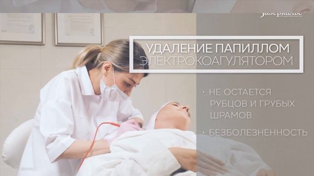 Удаление папиллом  безболезненное решение в Зазеркалье