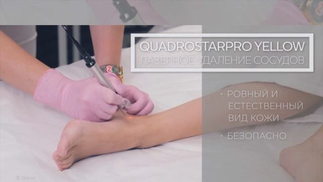Лазерное удаление сосудистых звездочек кожа без сосудистых недостатков в Зазеркалье