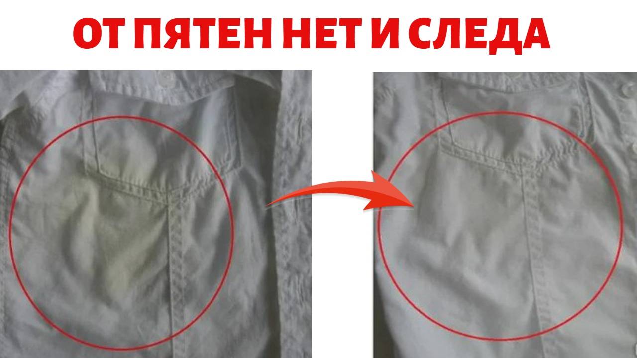 Самый рабочий способ, как удалить пятна на белой рубашке