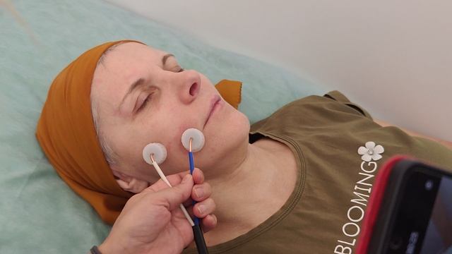 Стимуляция лицевого нерва