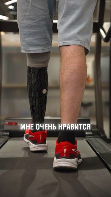 Показываем, как выглядит протез Влада в деталях.