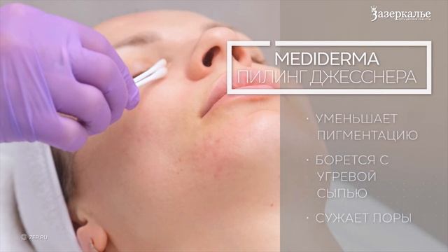 Пилинг Джесснера (Mediderma)  революция в уходе за кожей в Зазеркалье