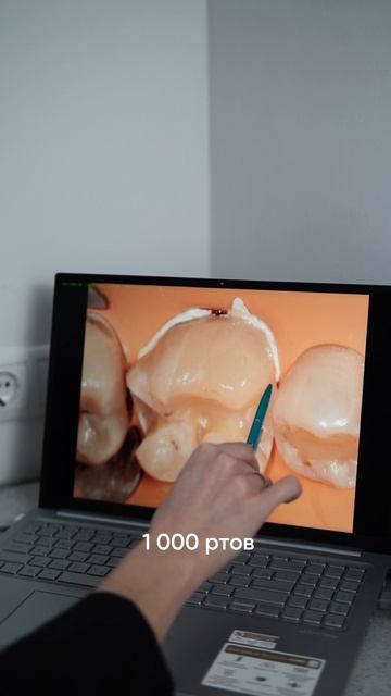 От чего зависит стоимость лечения