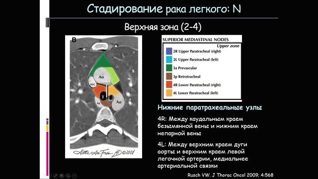 ЛД в онкологии. Часть 2 17. Лекция «Рак легкого». Лектор Шра(1)