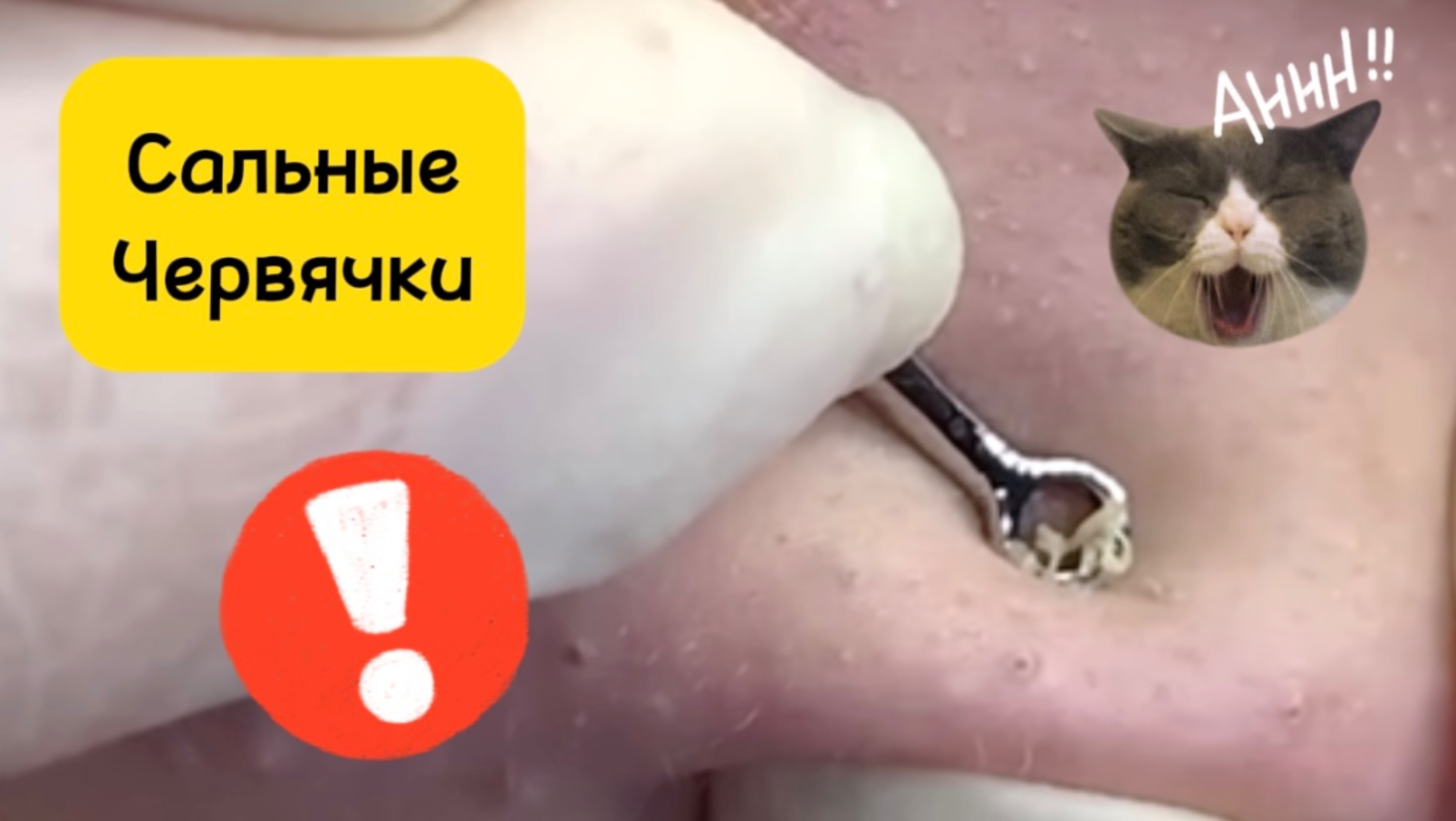 Очистка лица от угрей и акне.
Выдавливание прыщей. Удаление черных точек и комедонов.