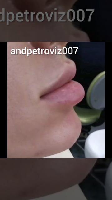 InShot_20250623_054614534.mp4