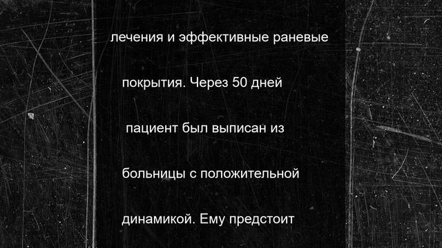 Орловские врачи спасли мужчину с раздробленными голенями