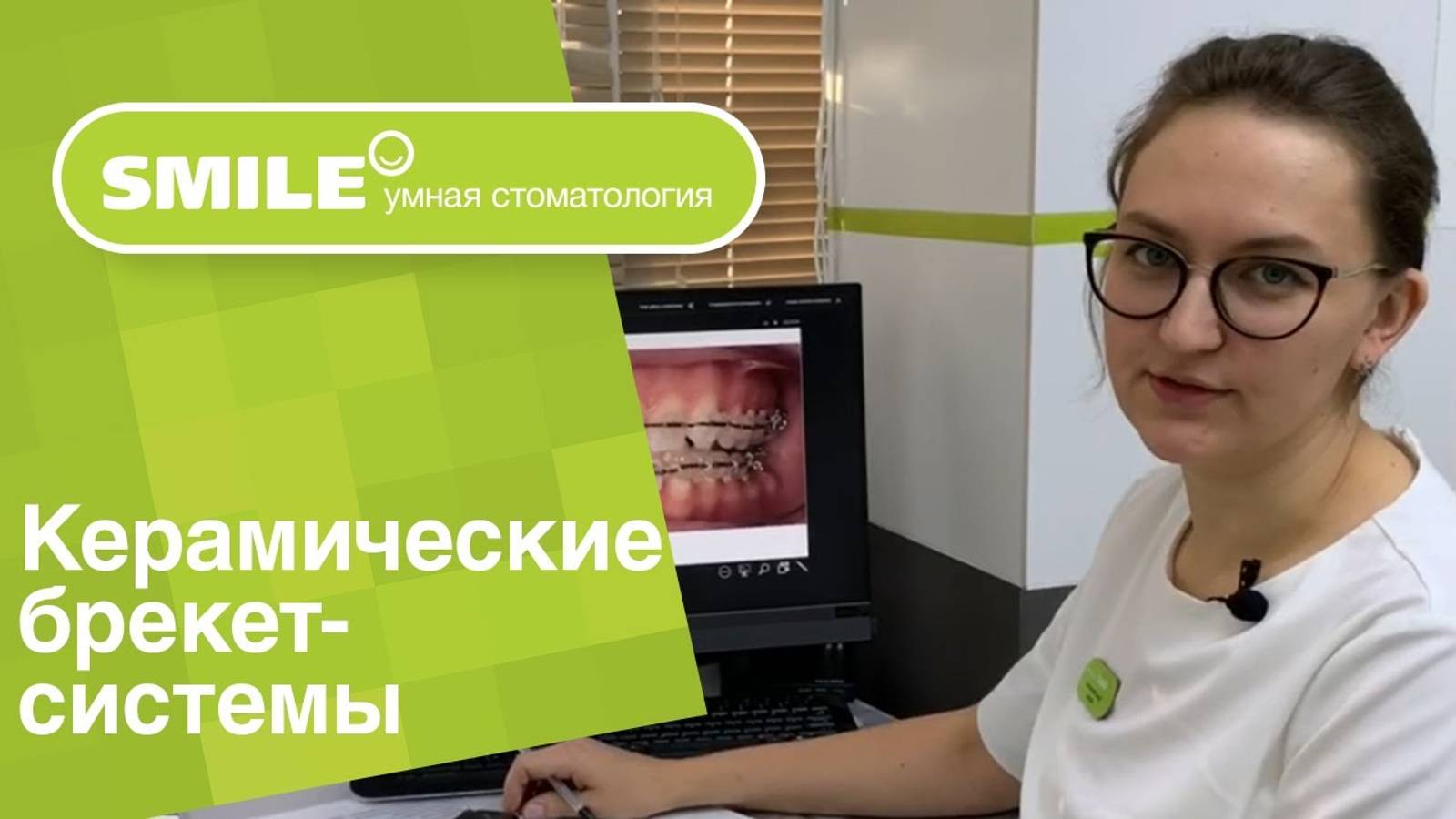 Керамические брекет-системы