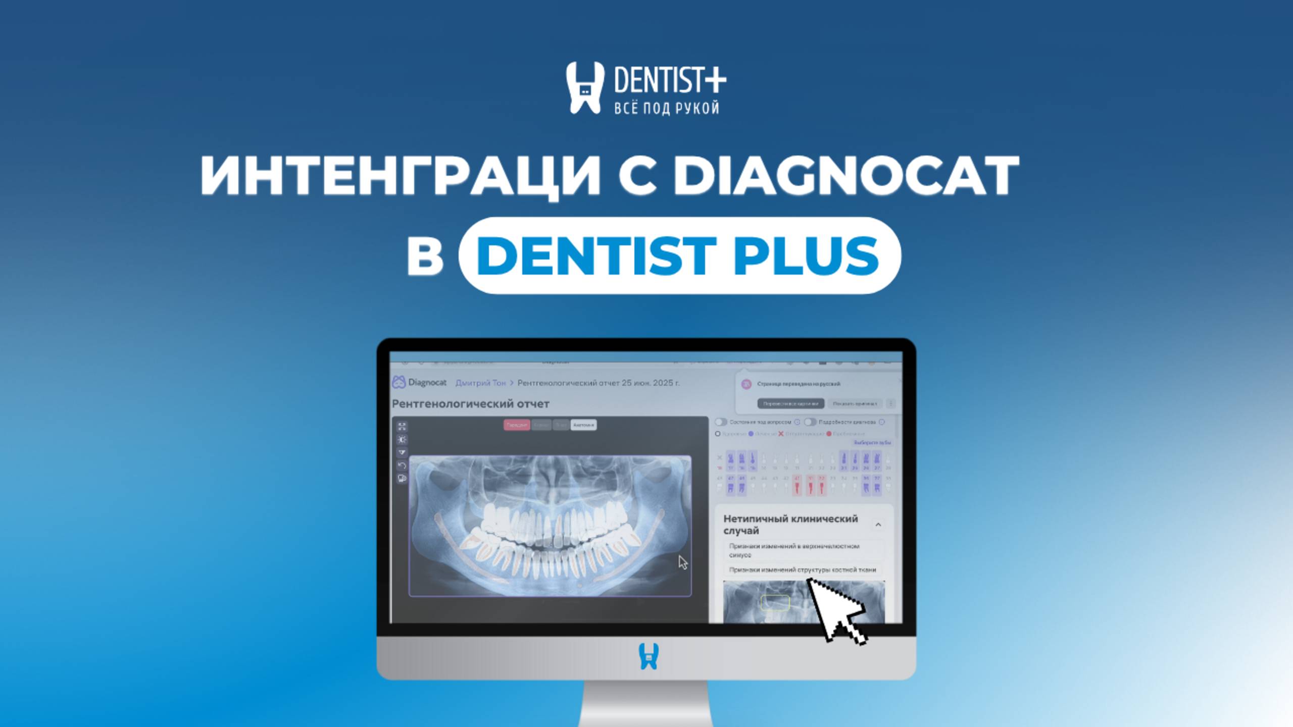 Интеграция с Diagnocat: как загружать и расшифровывать снимки прямо из карточки пациента | Dentist+