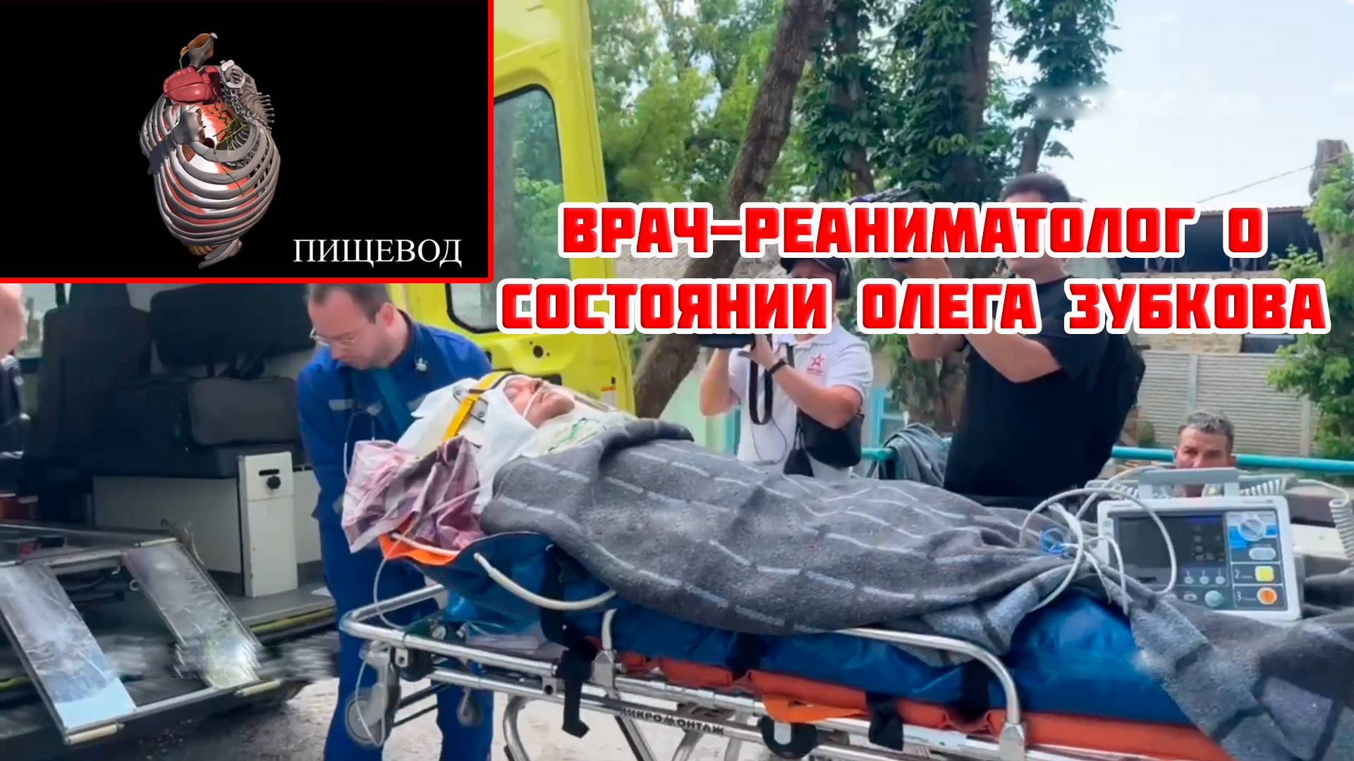 Врач-реаниматолог подробно о состоянии Зубкова на сегодняшний день