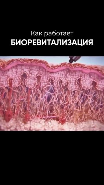 Биоревитализация