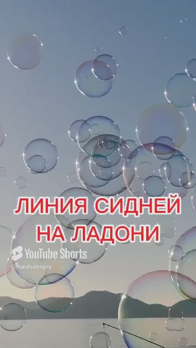 линия Сидней на ладони
