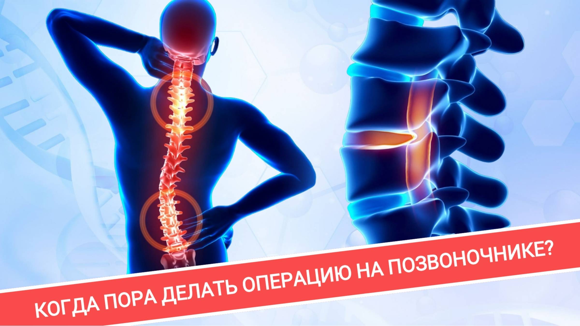БОЛЬ В ПОЯСНИЦЕ И НОГЕ. ИСТОРИЯ ПАЦИЕНТКИ