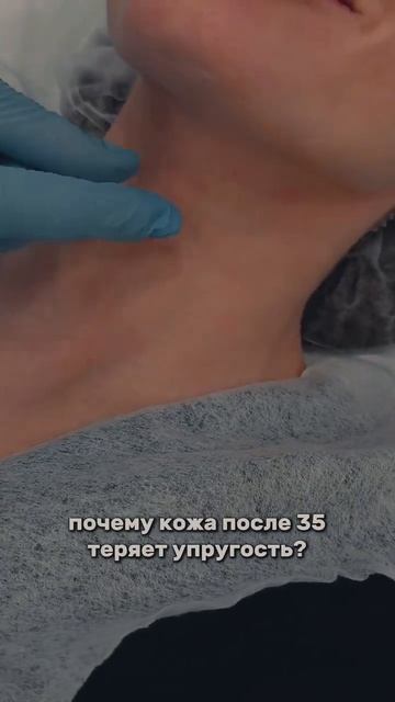 Уход за кожей после 35  #нанобьюти