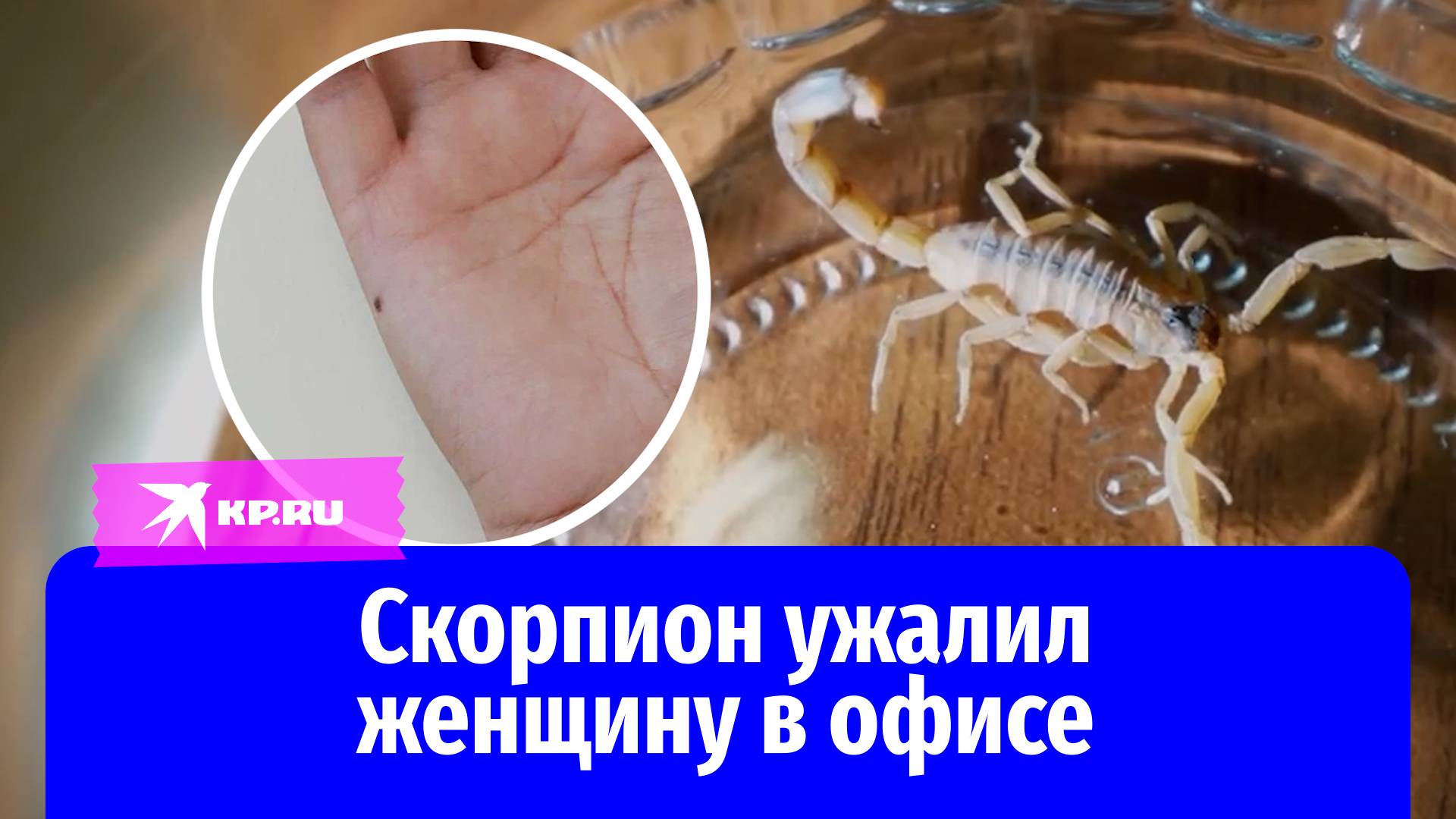 Врачи «Склифа» спасли москвичку от укуса скорпиона