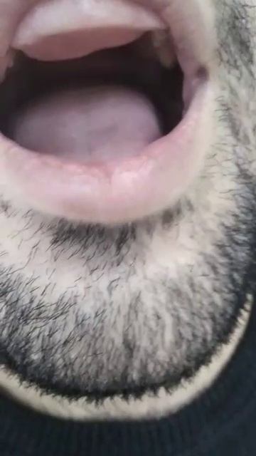 VID-20250618-WA0001.mp4