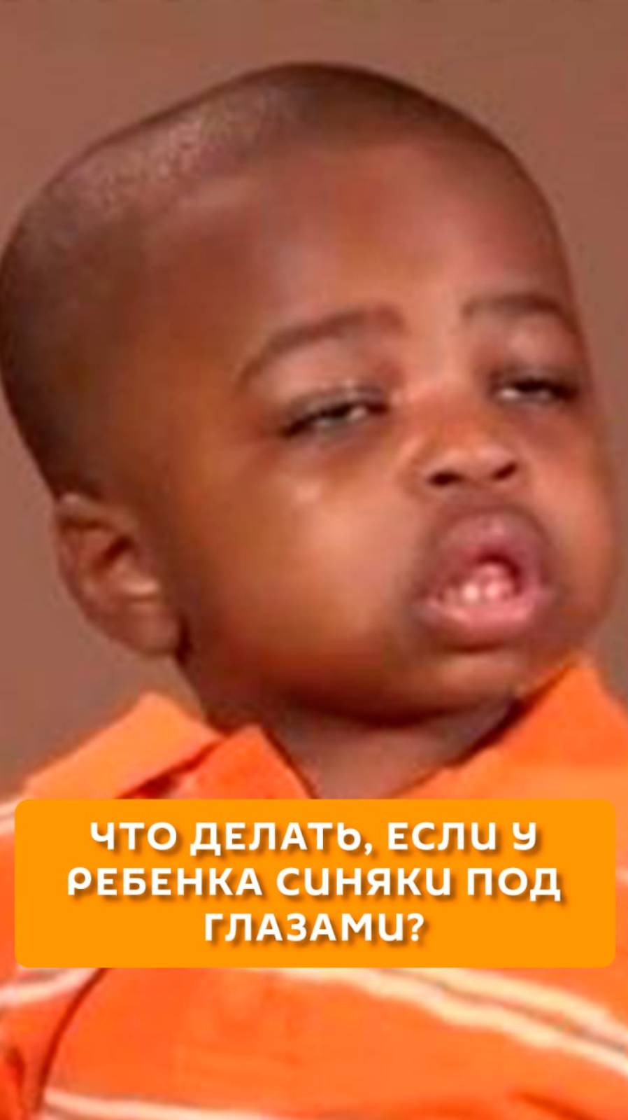 Что делать, если у ребенка синяки под глазами?