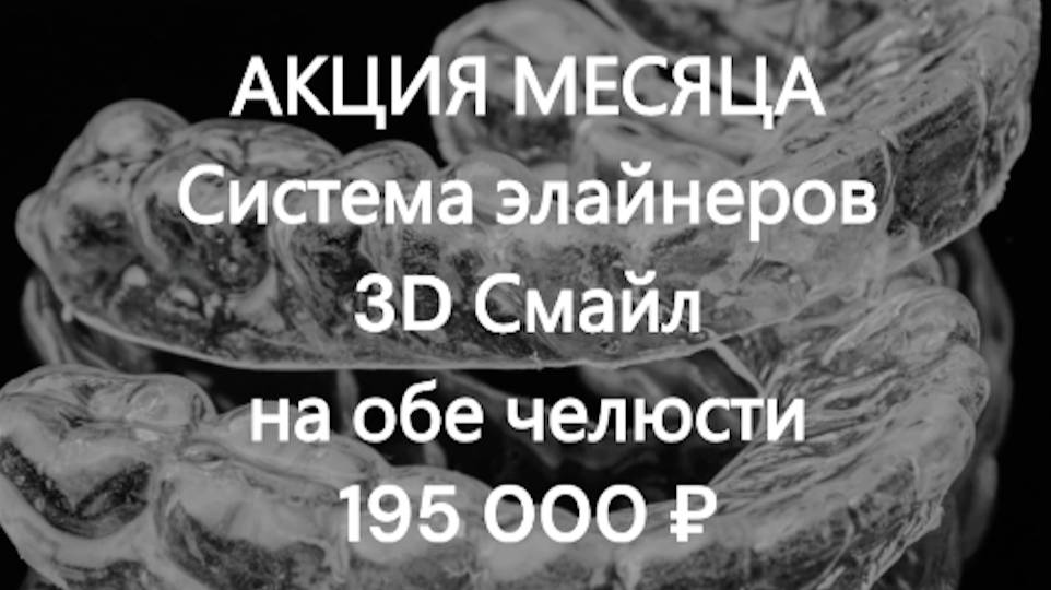 Элайнеры акция