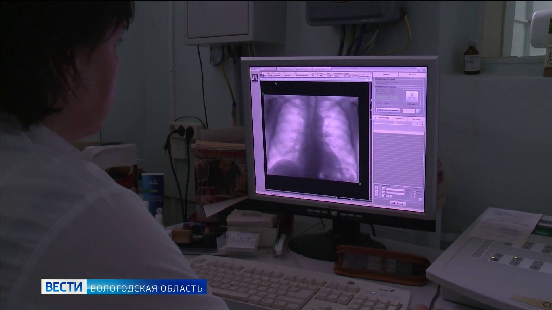 Вологодская область одной из первых обратила внимание на пагубную проблему вейпов