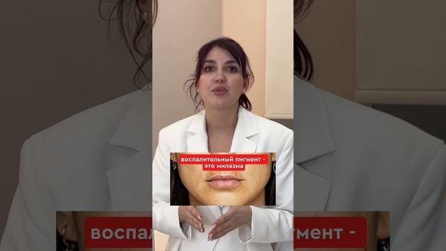 Пигментация