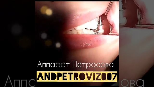 VID-20250623-WA0000.mp4