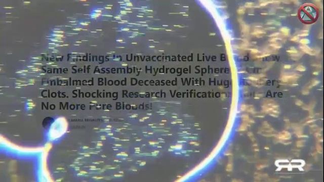 Кровь  содержит волокна и ткани наночастиц/Each person's blood contains fibers and tissues