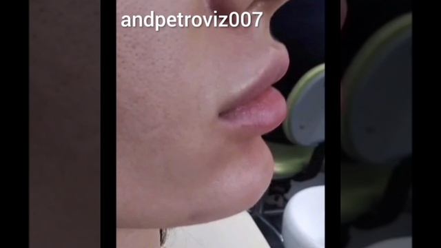 InShot_20250628_001237404.mp4