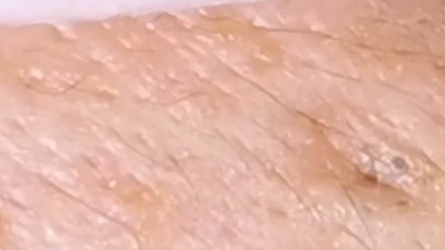 Механическая чистка лица