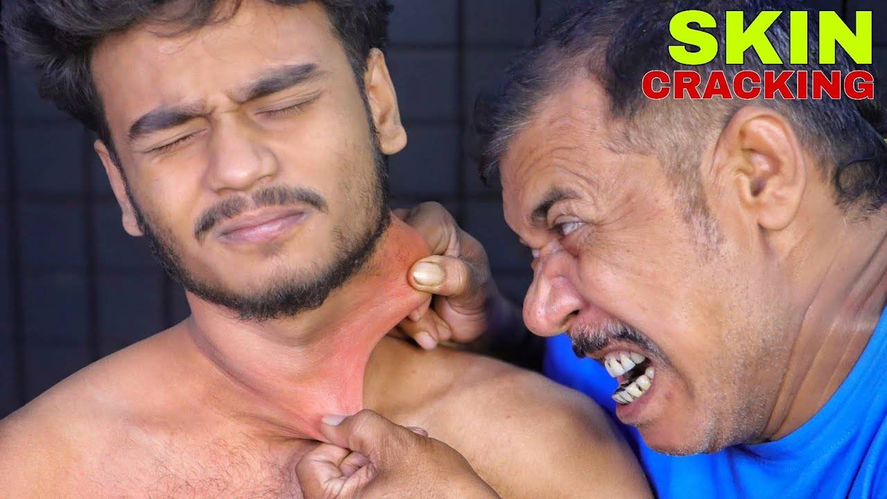 ASMR Deep Tissue Massage For Ultimate Relaxation ｜ Skin Cracking & Neck Cracking for Stress Relief