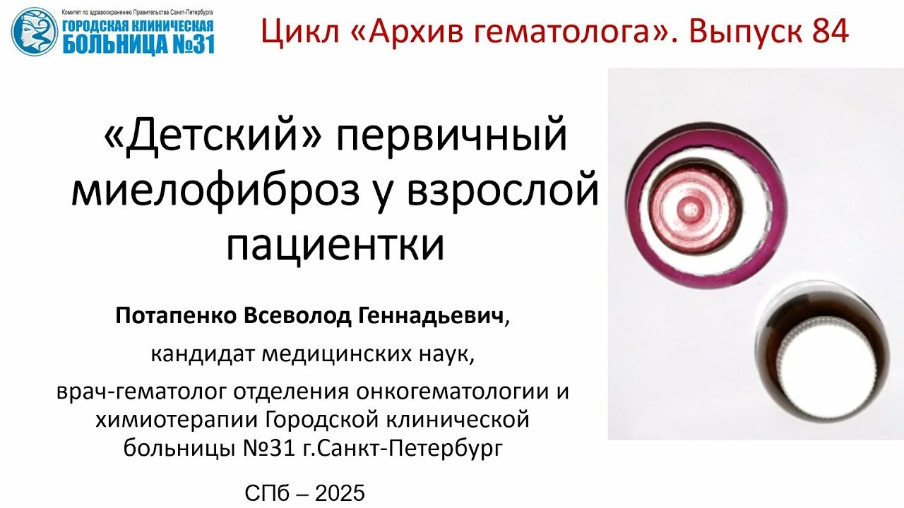 Архив гематолога 84. Врождённый первичный миелофиброз у взрослой женщины