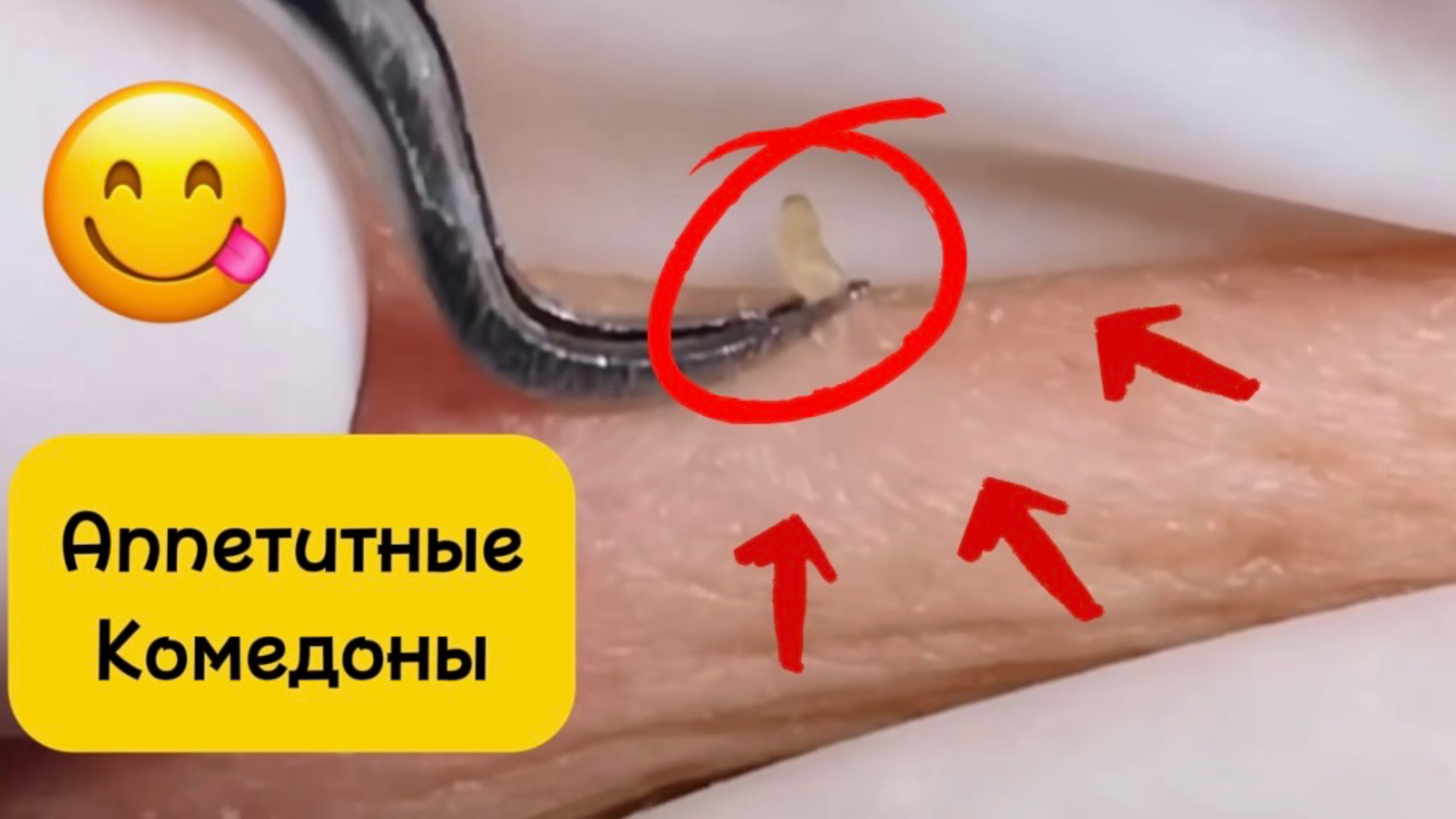 Механическая чистка лица