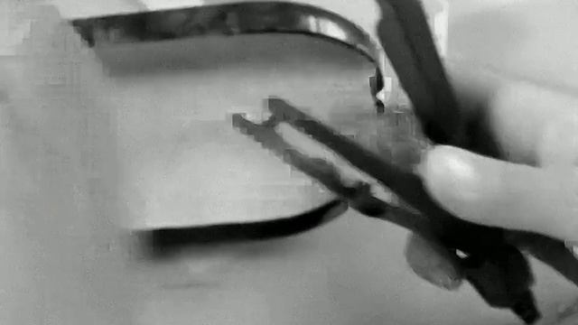 1970 год. Тюмень. Подбор ортопедической обуви