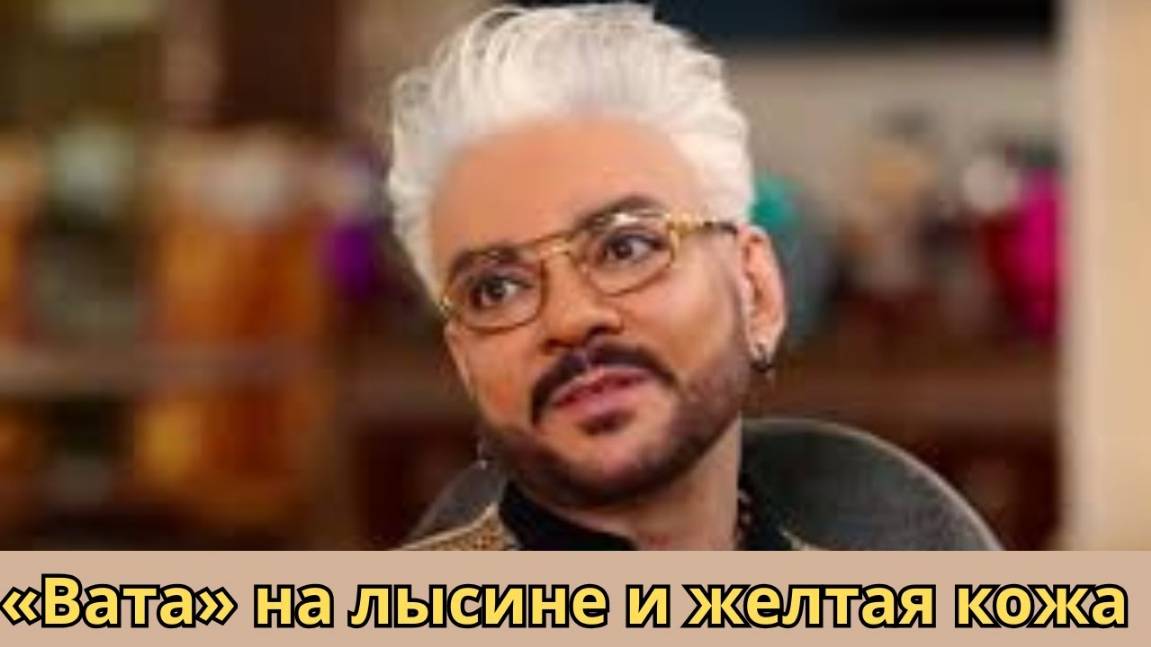 Внешний вид больного Киркорова Вызвал Шок