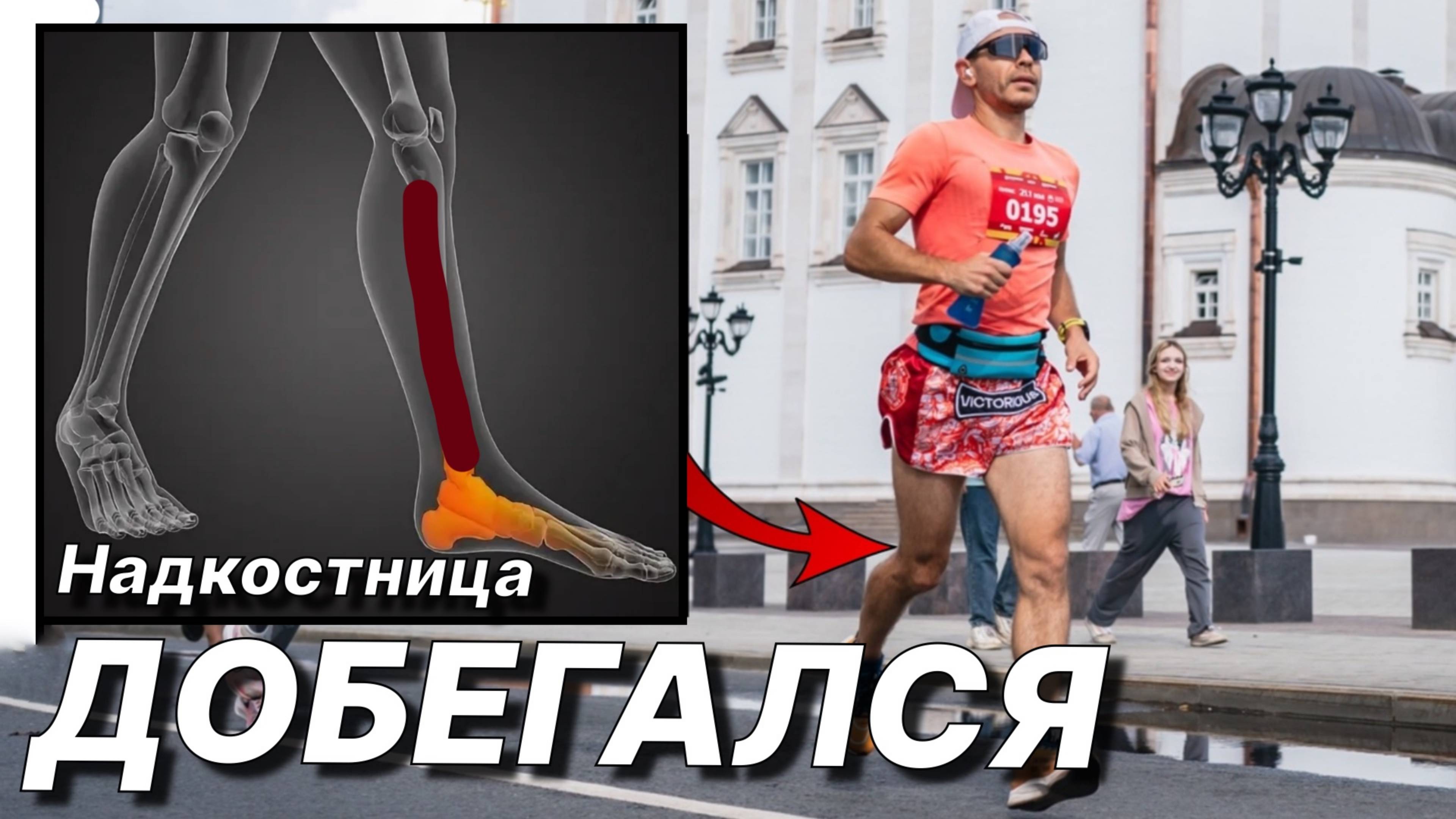 Воспаление НАДКОСТНИЦЫ. Как Лечить и как НЕдопустить